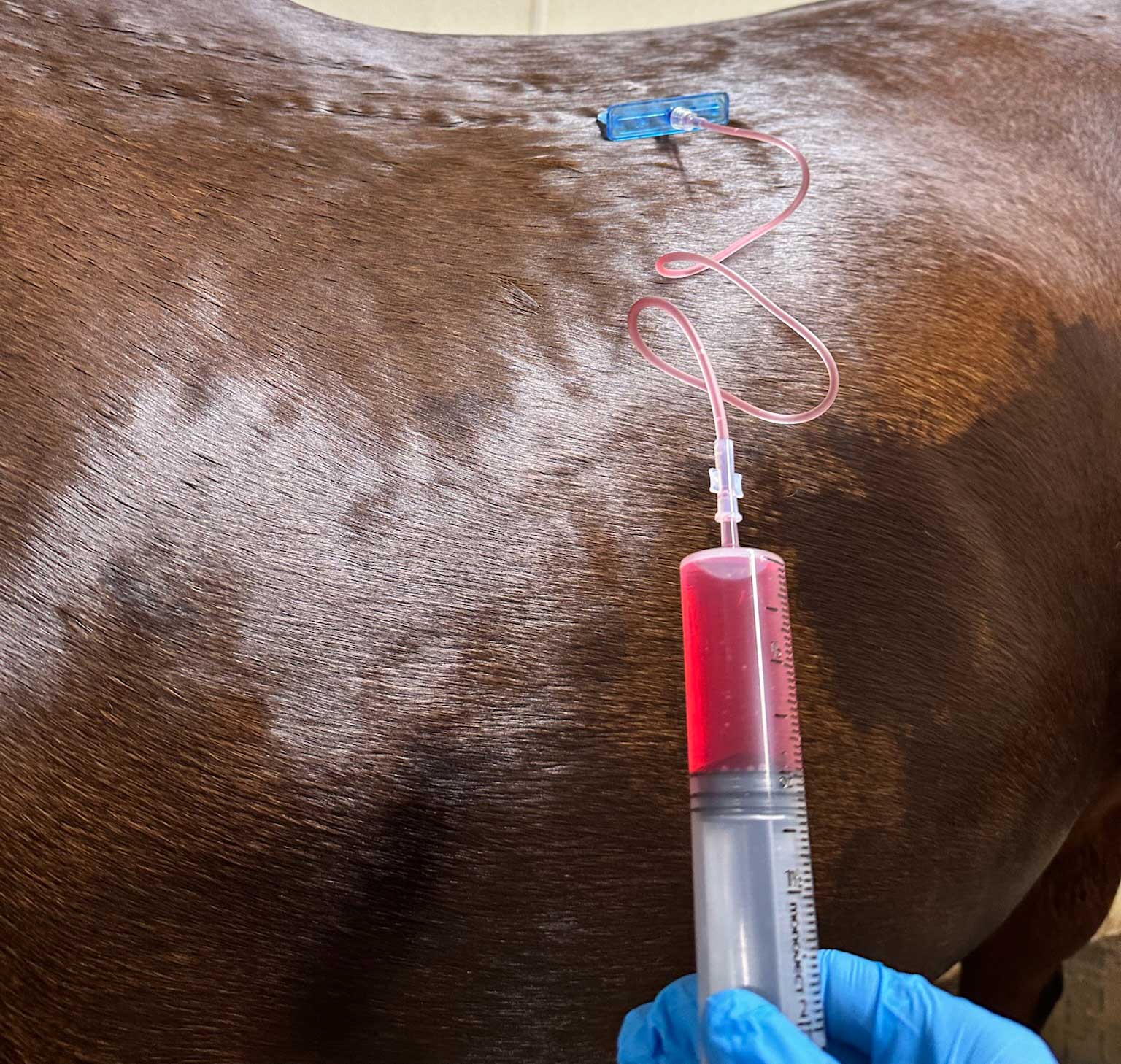 Mesotherapy